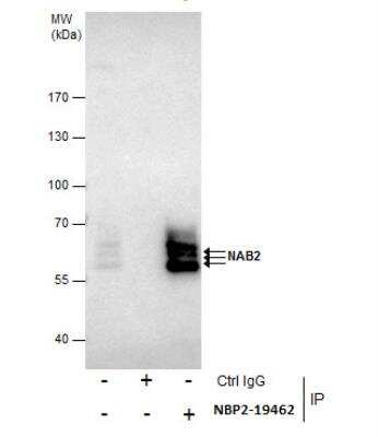 Immunoprecipitation: Nab2 Antibody [NBP2-19462]