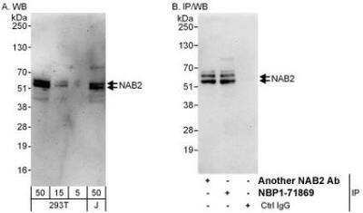 Western Blot: Nab2 Antibody [NBP1-71869]