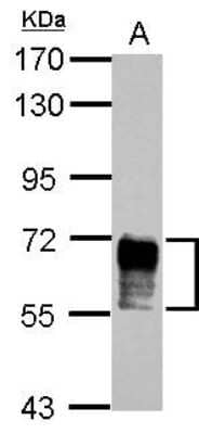 Western Blot: Nab2 Antibody [NBP2-19462]