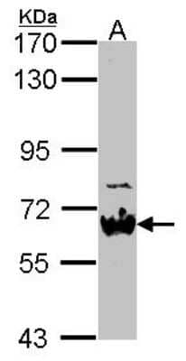 Western Blot: Nab2 Antibody [NBP2-19463]