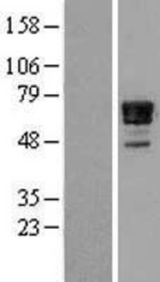 Western Blot: Nab2 Overexpression Lysate [NBL1-13453]