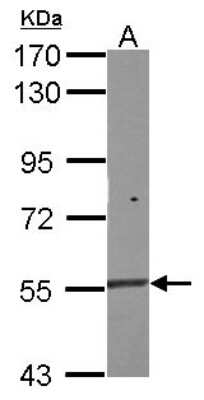 Western Blot: NAC1 Antibody [NBP2-19464]