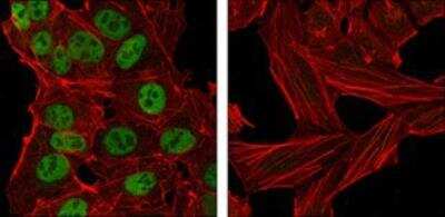 Immunocytochemistry/ Immunofluorescence: Nanog Antibody (1E6C4) - BSA Free [NBP1-47427]