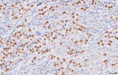 Immunohistochemistry-Paraffin: Nanog Antibody (5A10) - BSA Free [NBP1-04320]