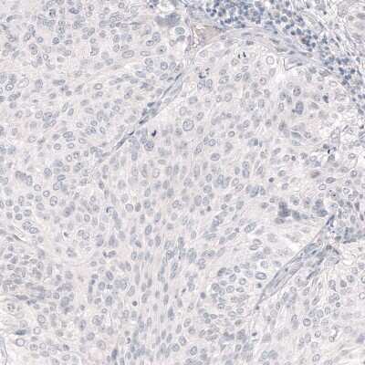 Immunohistochemistry-Paraffin: Nanog Antibody (CL5803) [NBP2-61428]