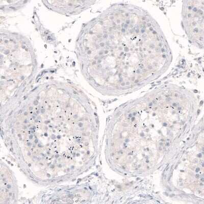 Immunohistochemistry-Paraffin: Nanog Antibody (CL5803) [NBP2-61428]