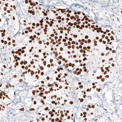 Immunohistochemistry-Paraffin: Nanog Antibody (CL5810) [NBP2-61429]