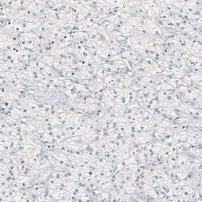 Immunohistochemistry-Paraffin: Nanog Antibody (CL5810) [NBP2-61429]