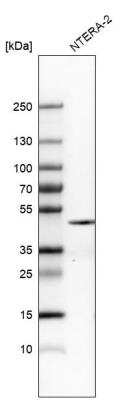 Western Blot: Nanog Antibody (CL5810) [NBP2-61429]