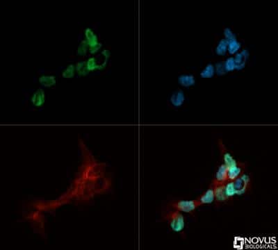 Immunocytochemistry/ Immunofluorescence: Nanog Antibody [NB100-58842]