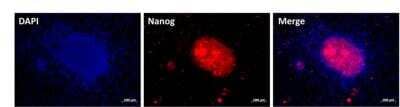 Immunocytochemistry/ Immunofluorescence: Nanog Antibody [NB100-58842]