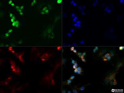 Immunocytochemistry/ Immunofluorescence: Nanog Antibody [NBP2-24941]