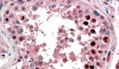 Immunohistochemistry: Nanog Antibody [NB100-59737]