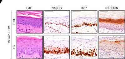 Immunohistochemistry-Paraffin: Nanog Antibody [NB100-58842]