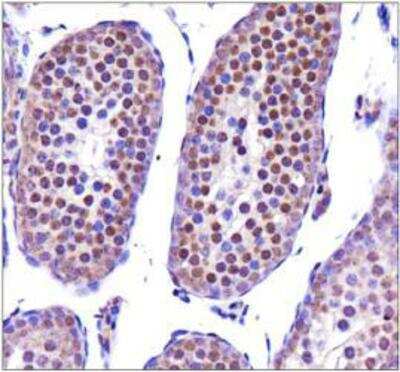 Immunohistochemistry-Paraffin: Nanog Antibody - BSA Free [NBP2-13177]