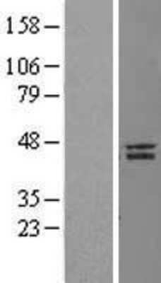 Western Blot: Nanog Overexpression Lysate [NBL1-13465]