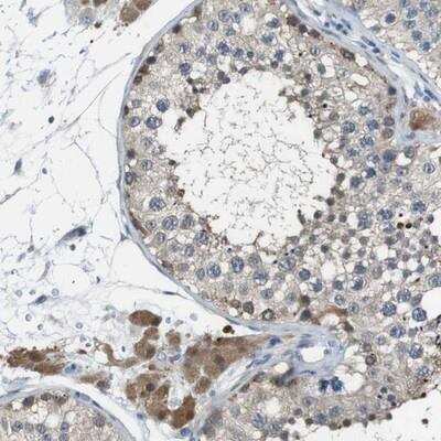 Immunohistochemistry-Paraffin: Nanos2 Antibody [NBP2-13638]