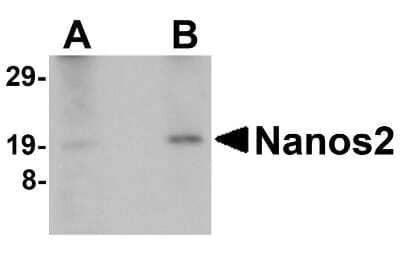 Western Blot: Nanos2 AntibodyBSA Free [NBP1-76370]