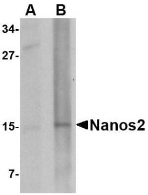 Western Blot: Nanos2 AntibodyBSA Free [NBP1-76917]