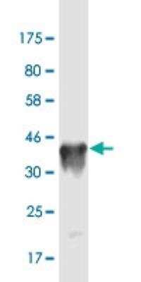 Western Blot: Nanos3 Antibody (4B11) [H00342977-M02-100ug]