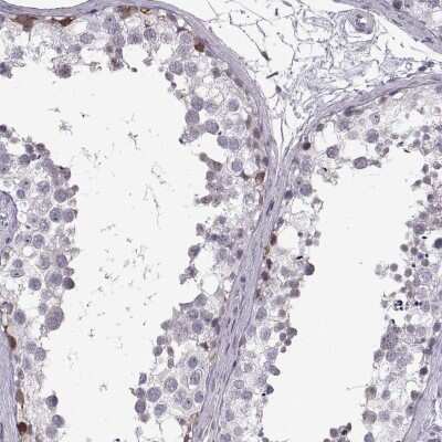 Immunohistochemistry-Paraffin: Nanos3 Antibody [NBP2-38011]