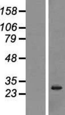 Western Blot: Nanos3 Overexpression Lysate [NBP2-08318]