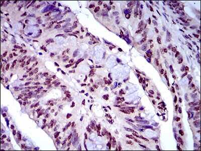 Immunohistochemistry: Napsin A Antibody (10C4B8) - BSA Free [NBP2-37355]