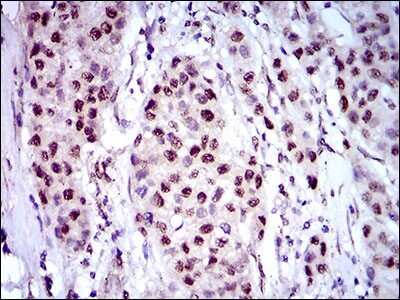 Immunohistochemistry: Napsin A Antibody (10C4B8) - BSA Free [NBP2-37355]