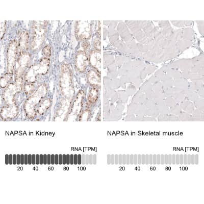 Immunohistochemistry-Paraffin: Napsin A Antibody (CL12954) [NBP3-18551]