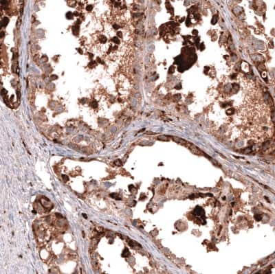 Immunohistochemistry-Paraffin: Napsin A Antibody (CL12954) [NBP3-18551]