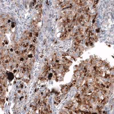 Immunohistochemistry-Paraffin: Napsin A Antibody (CL12954) [NBP3-18551]