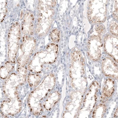 Immunohistochemistry-Paraffin: Napsin A Antibody (CL12954) [NBP3-18551]