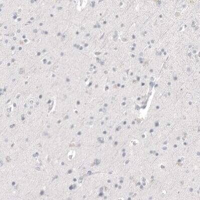 Immunohistochemistry-Paraffin: Napsin A Antibody (CL12954) [NBP3-18551]