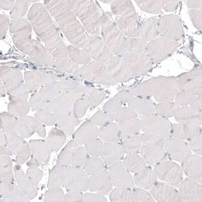 Immunohistochemistry-Paraffin: Napsin A Antibody (CL12954) [NBP3-18551]