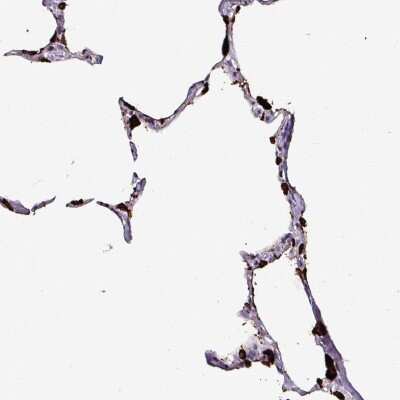 Immunohistochemistry-Paraffin: Napsin A Antibody [NBP2-34212]