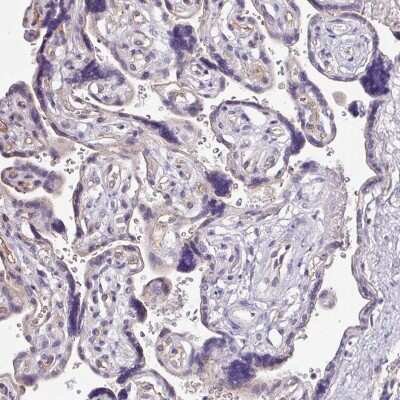 Immunohistochemistry-Paraffin: Napsin A Antibody [NBP2-34212]