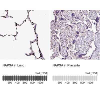 Immunohistochemistry-Paraffin: Napsin A Antibody [NBP2-34212]