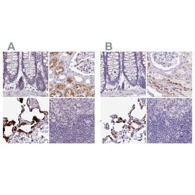 Immunohistochemistry-Paraffin: Napsin A Antibody [NBP2-34212]