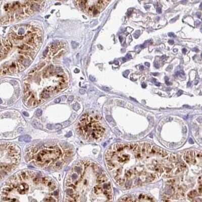 Immunohistochemistry-Paraffin: Napsin A Antibody [NBP2-34212]