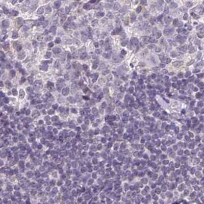 Immunohistochemistry-Paraffin: Napsin A Antibody [NBP2-34212]