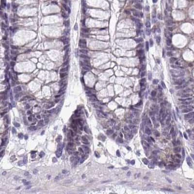 Immunohistochemistry-Paraffin: Napsin A Antibody [NBP2-34212]