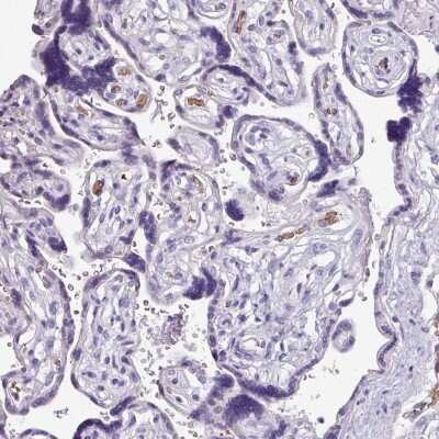 Immunohistochemistry-Paraffin: Napsin A Antibody [NBP2-34213]