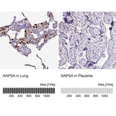 Immunohistochemistry-Paraffin: Napsin A Antibody [NBP2-34213]