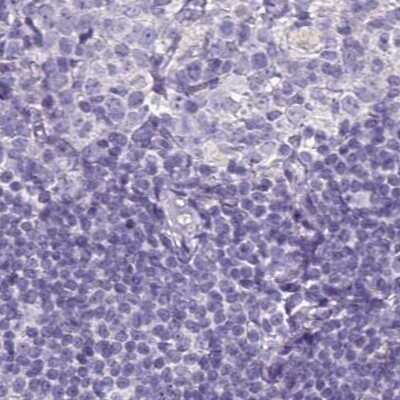 Immunohistochemistry-Paraffin: Napsin A Antibody [NBP2-34213]