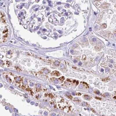 Immunohistochemistry-Paraffin: Napsin A Antibody [NBP2-34213]