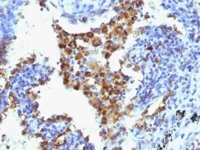 Immunohistochemistry-Paraffin: Napsin A Antibody (NAPSA/1238 + NAPSA/1239) [NBP2-45246]