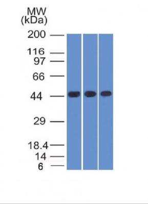 Western Blot: Napsin A Antibody (NAPSA/1238 + NAPSA/1239) [NBP2-45246]