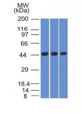 Western Blot: Napsin A Antibody (NAPSA/1238 + NAPSA/1239)BSA Free [NBP2-54391]