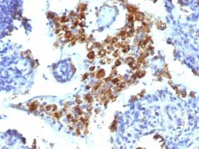 Immunohistochemistry-Paraffin: Napsin A Antibody (NAPSA/1238) - BSA Free [NBP2-54383]