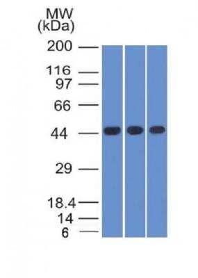 Western Blot: Napsin A Antibody (NAPSA/1238) [NBP2-45244]